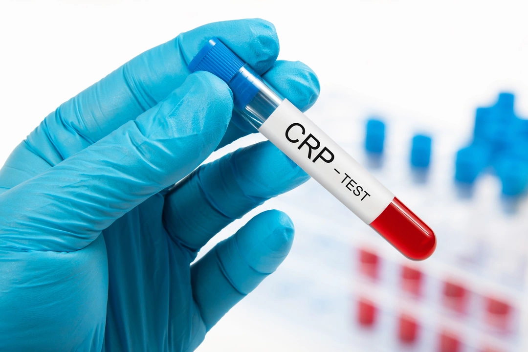 The importance of regular blood tests during capecitabine treatment